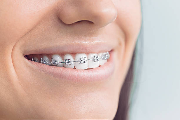 Best Invisalign and Clear Aligners  in Forest Park, OH